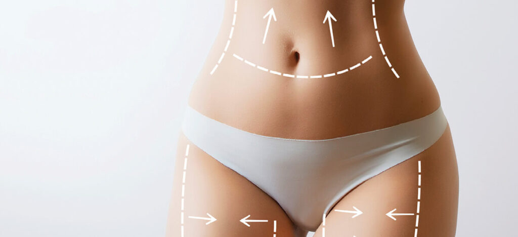 HIFU Body Treatment