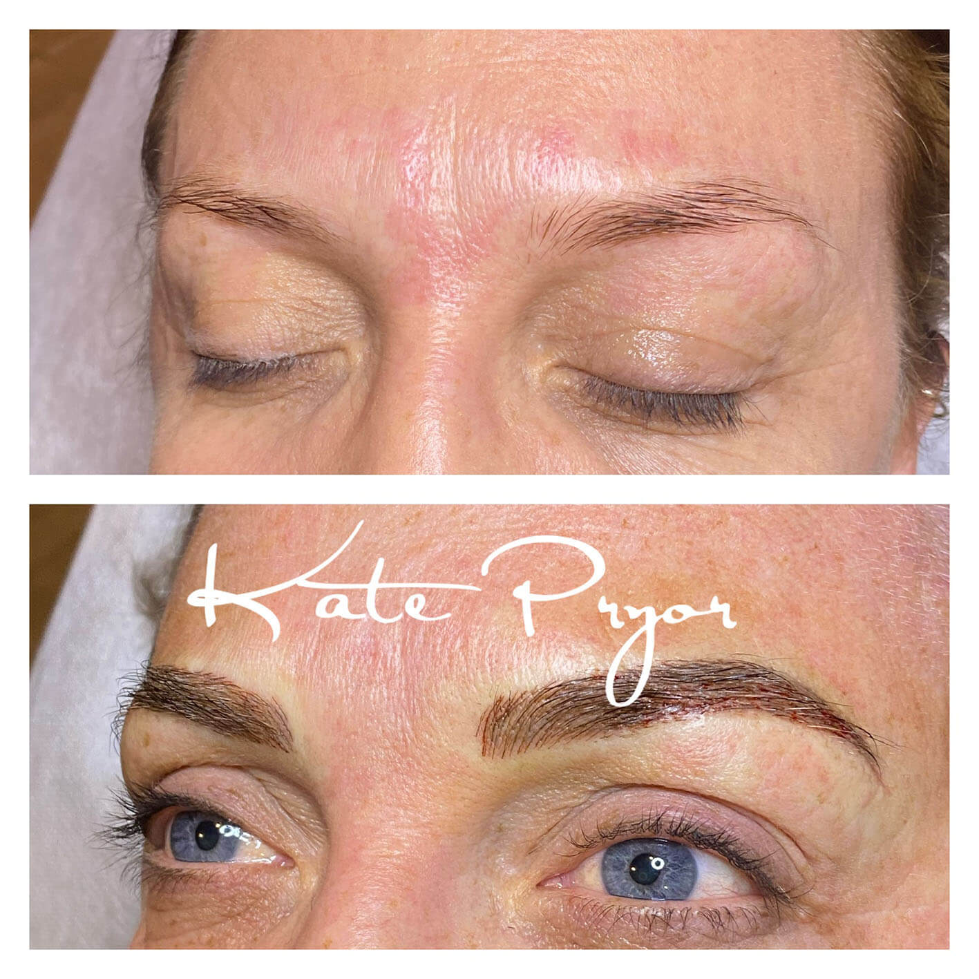 Elite-Skin-Cosmetic-Tattooing-Kate-Pryor-Before-After-12