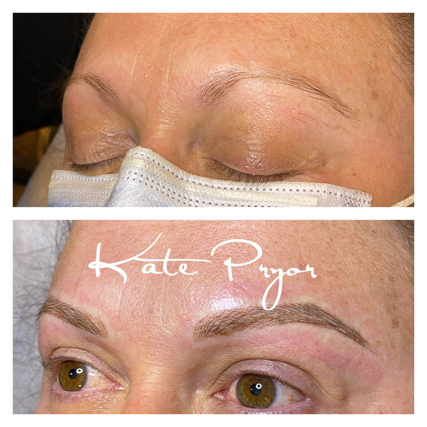 Elite-Skin-Cosmetic-Tattooing-Kate-Pryor-Before-After-13