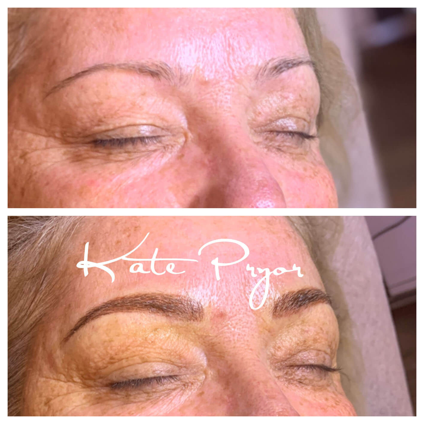 Elite-Skin-Cosmetic-Tattooing-Kate-Pryor-Before-After-15