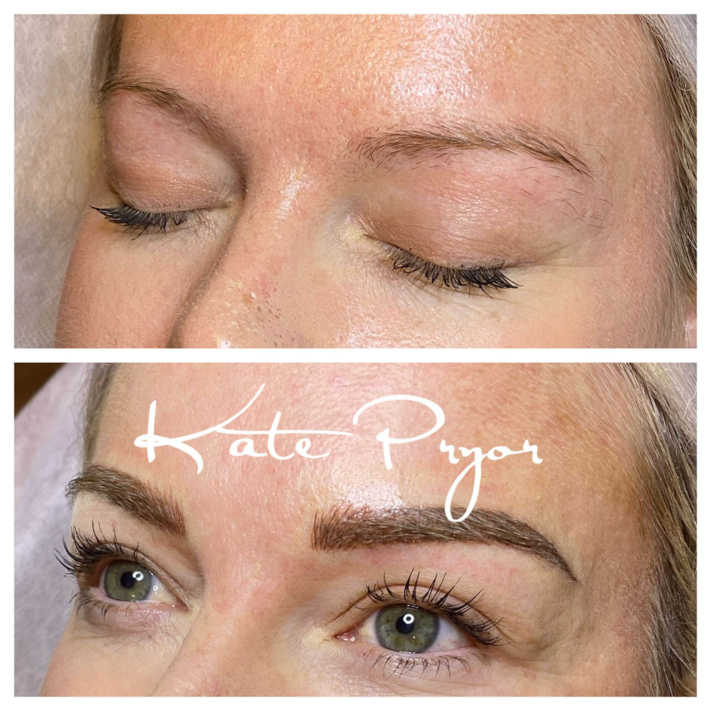 Elite-Skin-Cosmetic-Tattooing-Kate-Pryor-Before-After-18