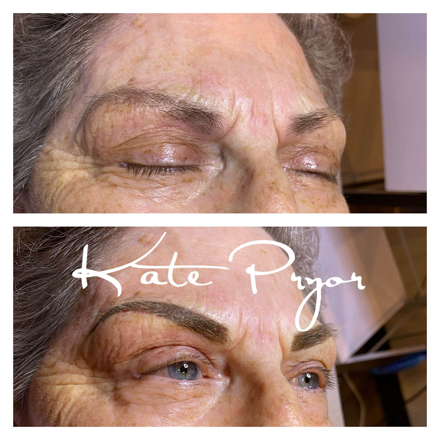 Elite-Skin-Cosmetic-Tattooing-Kate-Pryor-Before-After-2