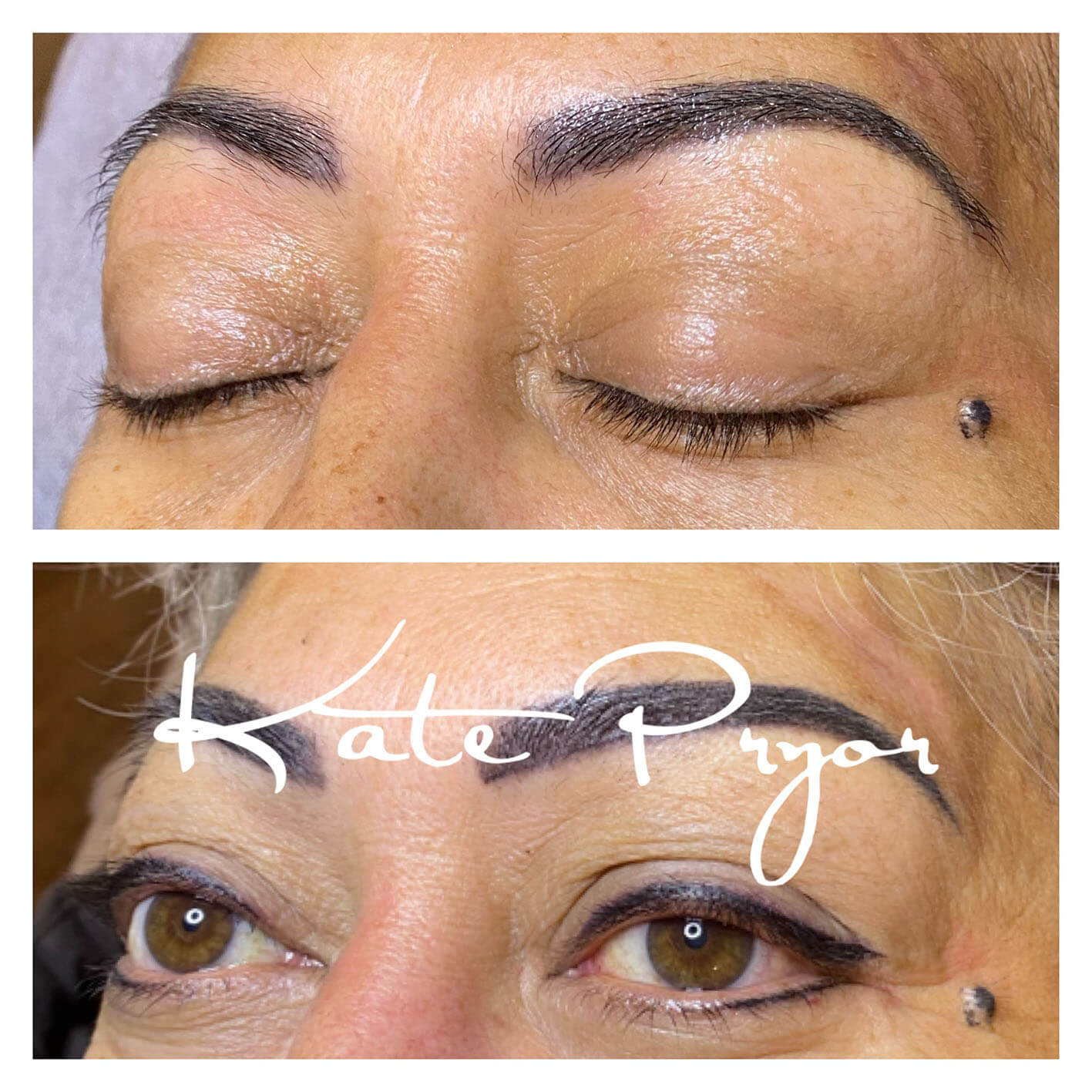 Elite-Skin-Cosmetic-Tattooing-Kate-Pryor-Before-After-21