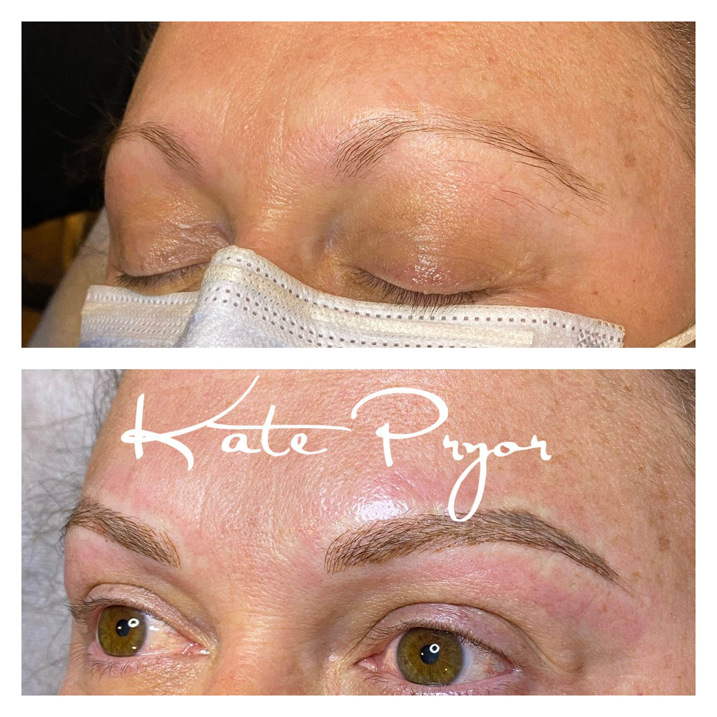 Elite-Skin-Cosmetic-Tattooing-Kate-Pryor-Before-After-22
