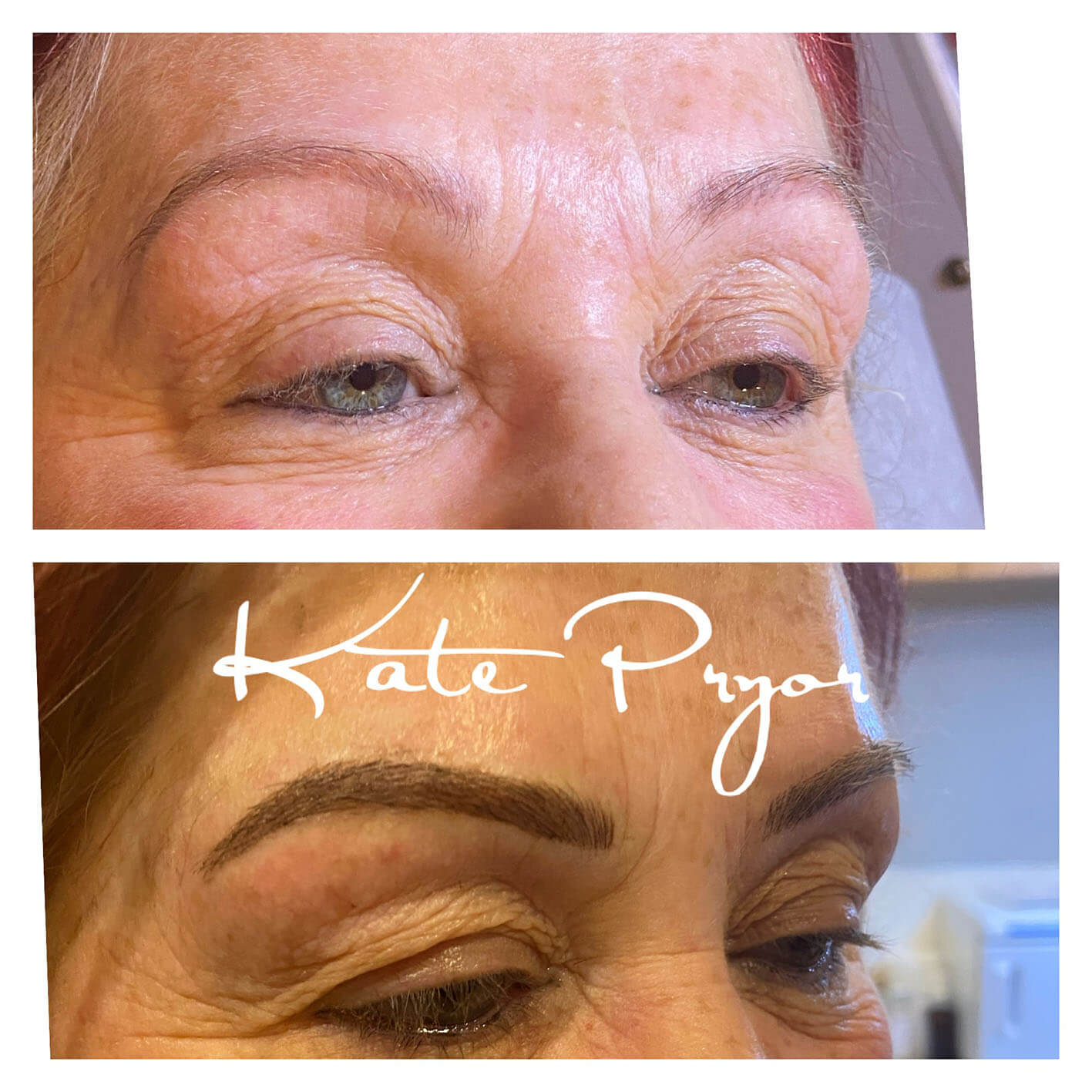 Elite-Skin-Cosmetic-Tattooing-Kate-Pryor-Before-After-8